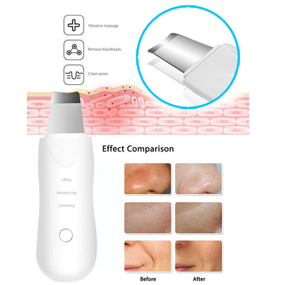 RevyaSkin Ultrasonic Skin Scrubber
